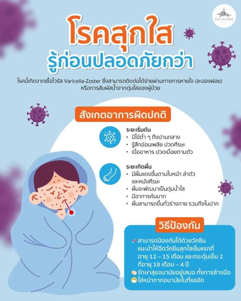โรคสุกใส